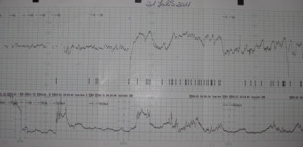 Pek - Statistics!